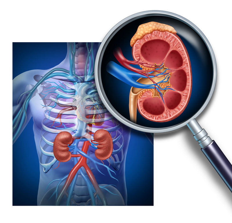 Chronic Kidney Disease